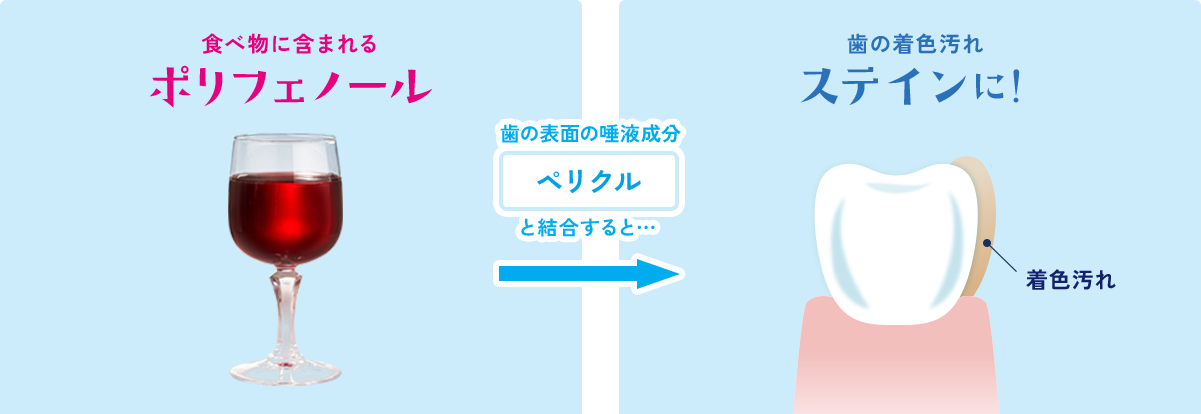 歯にステインがつく仕組みイメージ